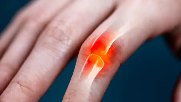 osteoatroz 1200x675.png