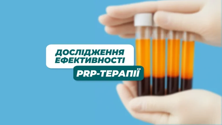 doslidzhennya prp 2 1200x675.jpg